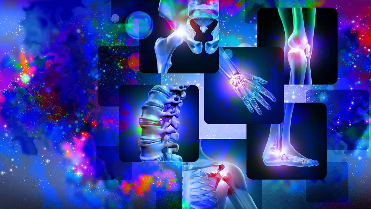 230403 Wdg Fibromyalgie 4